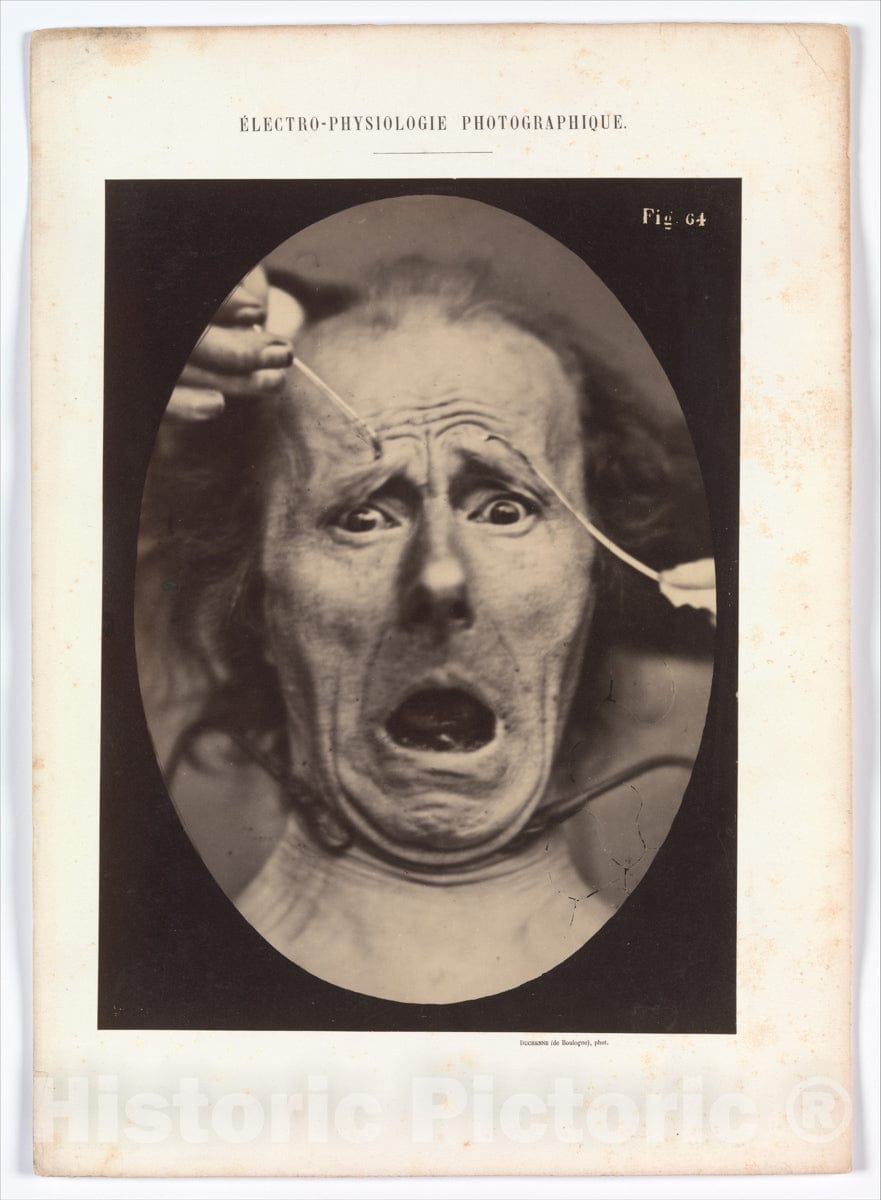 Photo Print : Adrien Tournachon - Electro–Physiologie, Figure 64 : Vintage Wall Art