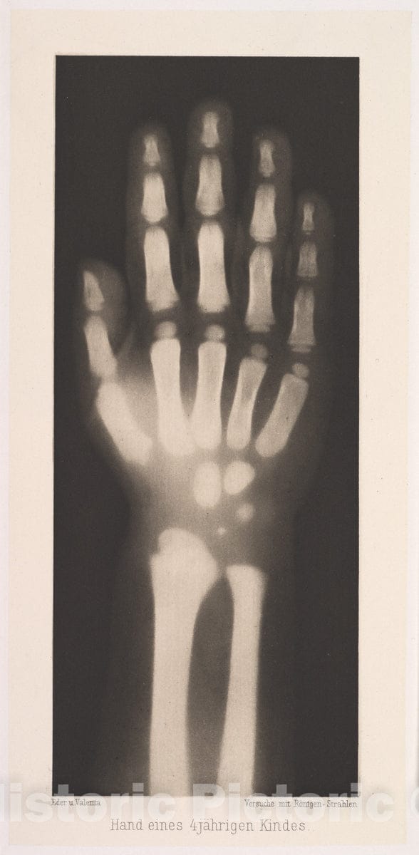 Art Print : Josef Maria Eder - Hand eines 4 jährigen Kindes : Vintage Wall Art