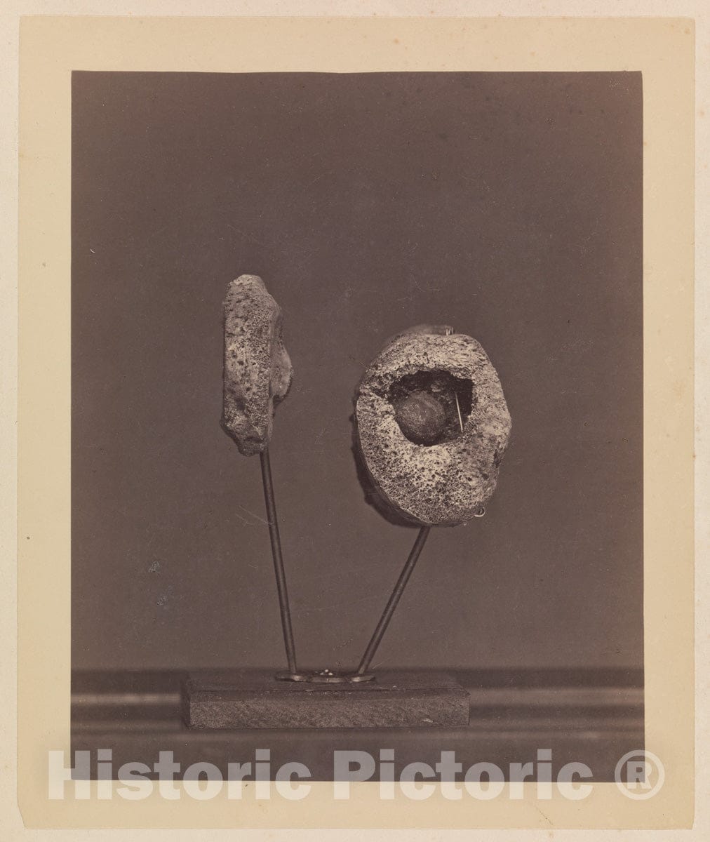 Photo Print : Excised Knee Joint. A Round Musket Ball in The Inner Condyle of The Right Femur Gardiner Lewis - Artist: William Bell - Created: 1866–67 : Vintage Wall Art